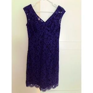 Lilly Pulitzer Rosaline Navy Lace Dress